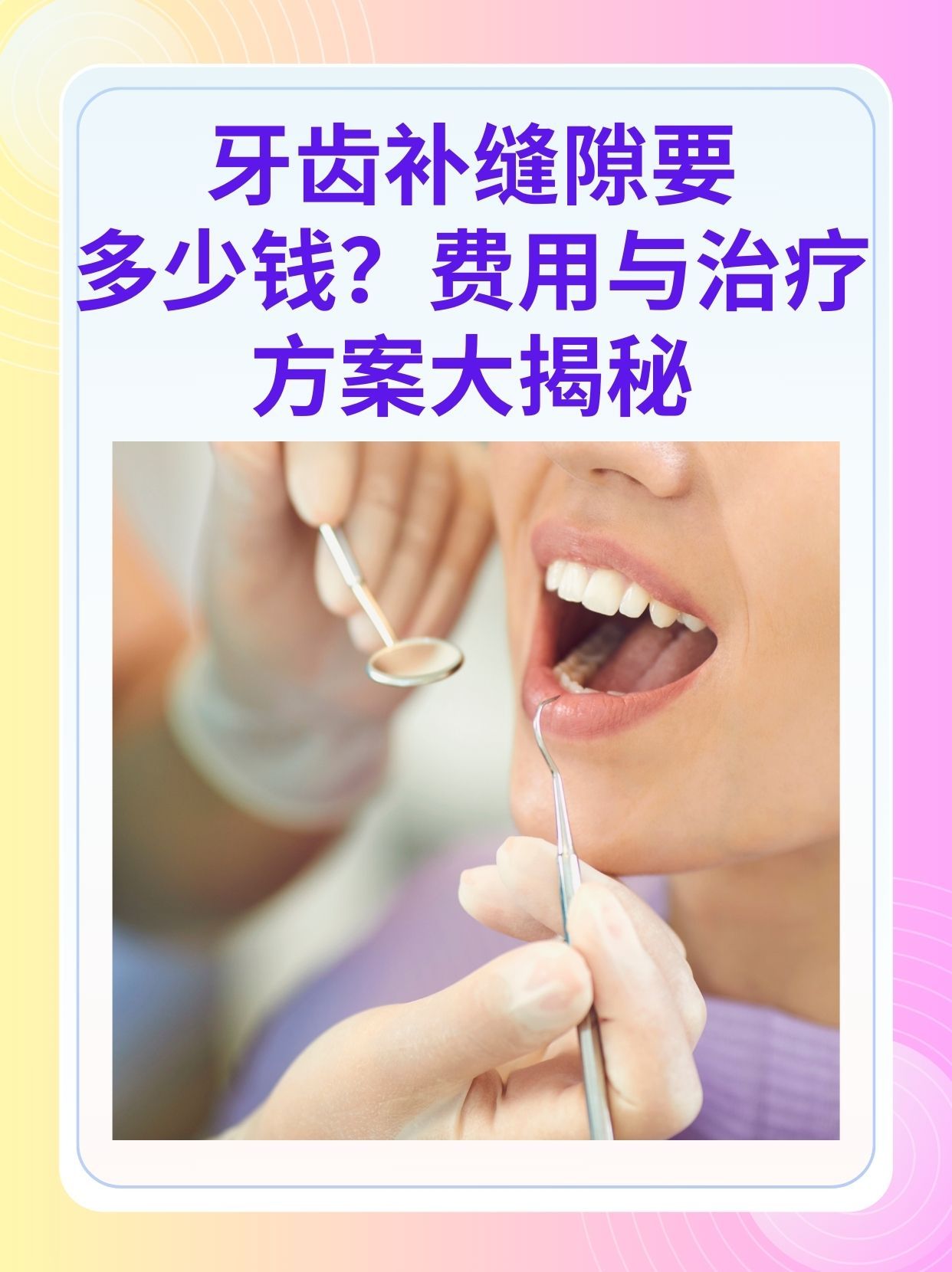 河池补牙医保可以报销吗(补牙医保可以报销吗 哪些可以报销呢)